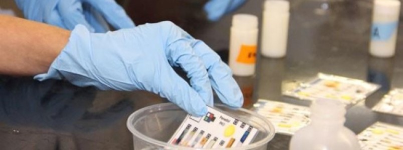 Laboratrio japons testar deteco de cncer com mostras de urina